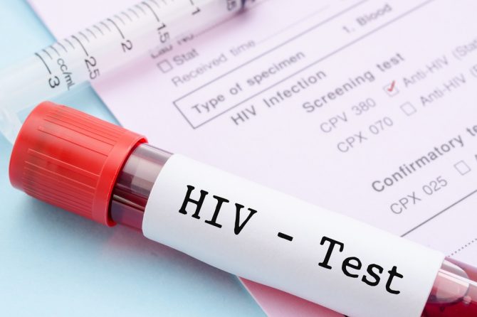 Besplatno testiranje na HIV